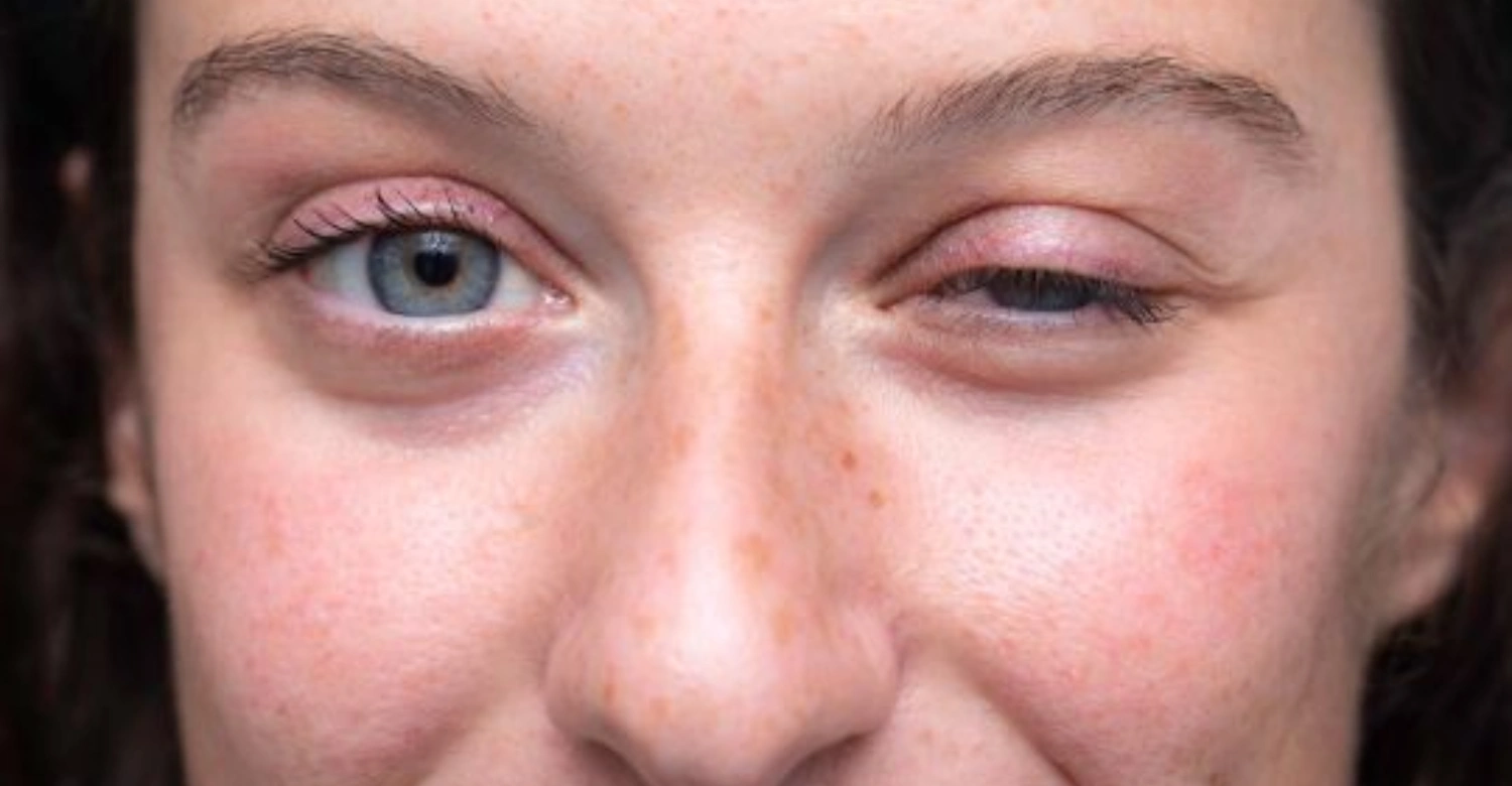Myasthenia gravis and dental implants1